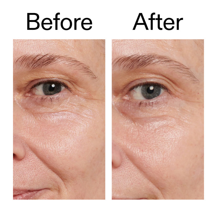Before and after comparison of a person's eye area with visible aging signs.