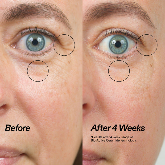 Bio-Active Ceramide Eye Cream