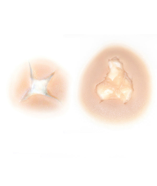 Bullet Hole & Exit Wound Kit 2