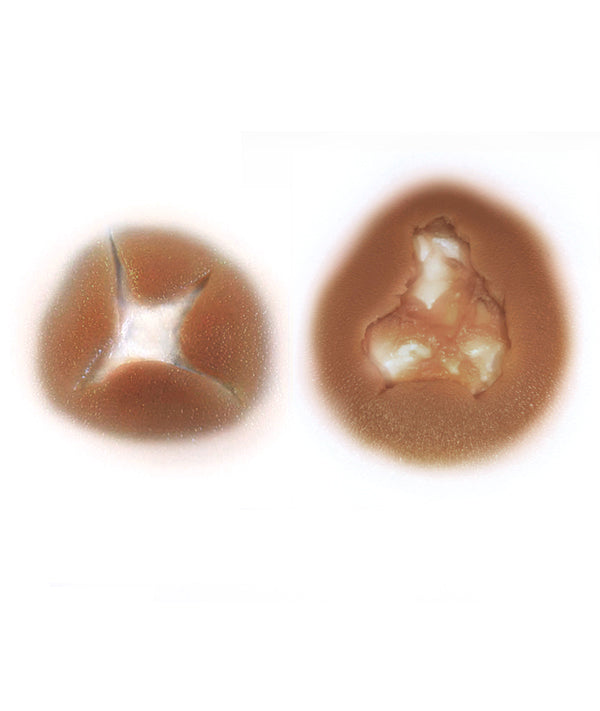 Bullet Hole & Exit Wound Kit 2