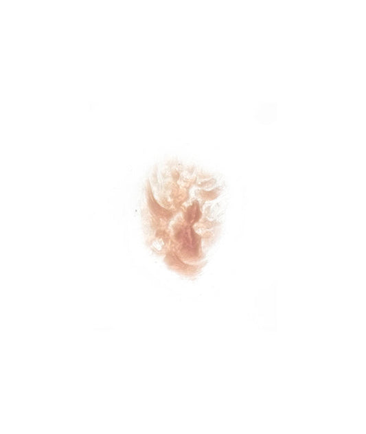 Burn 7
