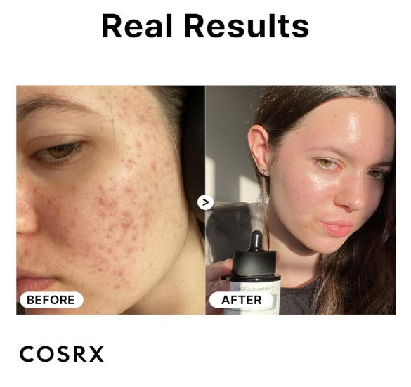 COSRX 15% Niacinamide Face Serum 20ml / 0.67 fl. oz.