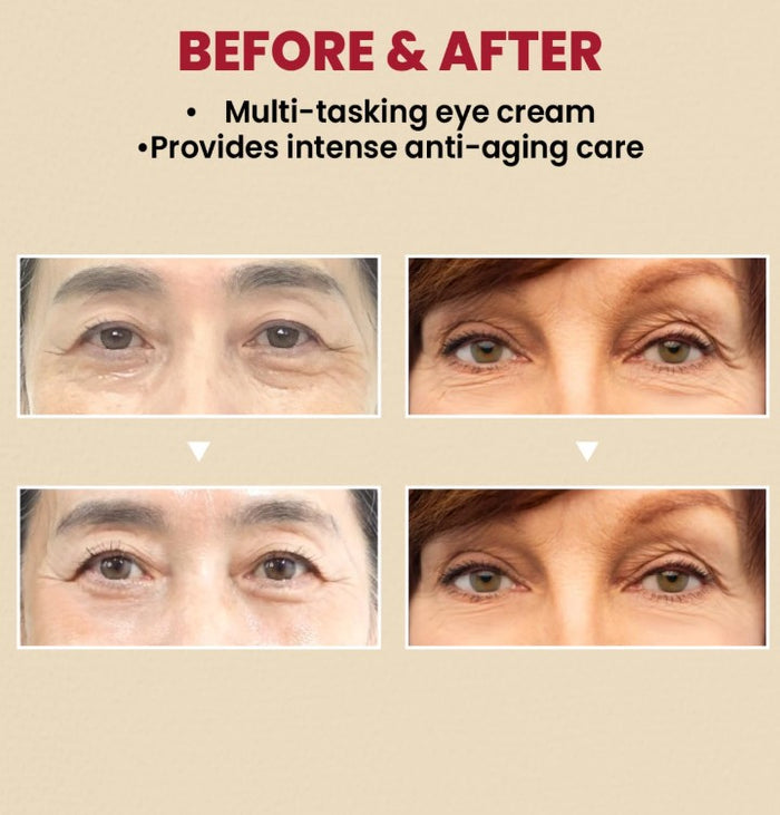 K-SECRET SEOUL 1988 Eye Cream : Retinal Liposome 4% + Fermented Bean, 30ml / 1.01 fl.oz.