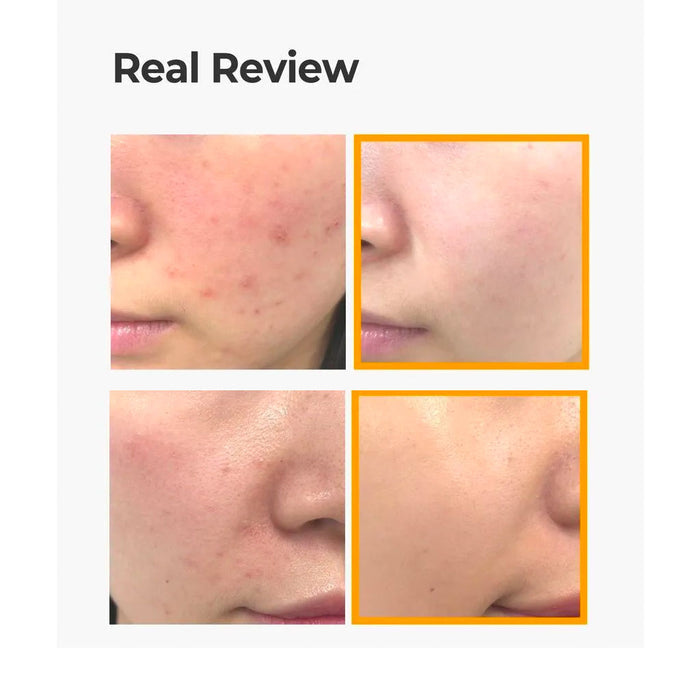 Some By Mi Propolis B5 Glow Barrier Calming Serum Nudie Glow Australia Review
