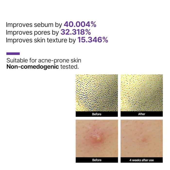 SOME BY MI Retinol Intense Reactivating Serum 10ml