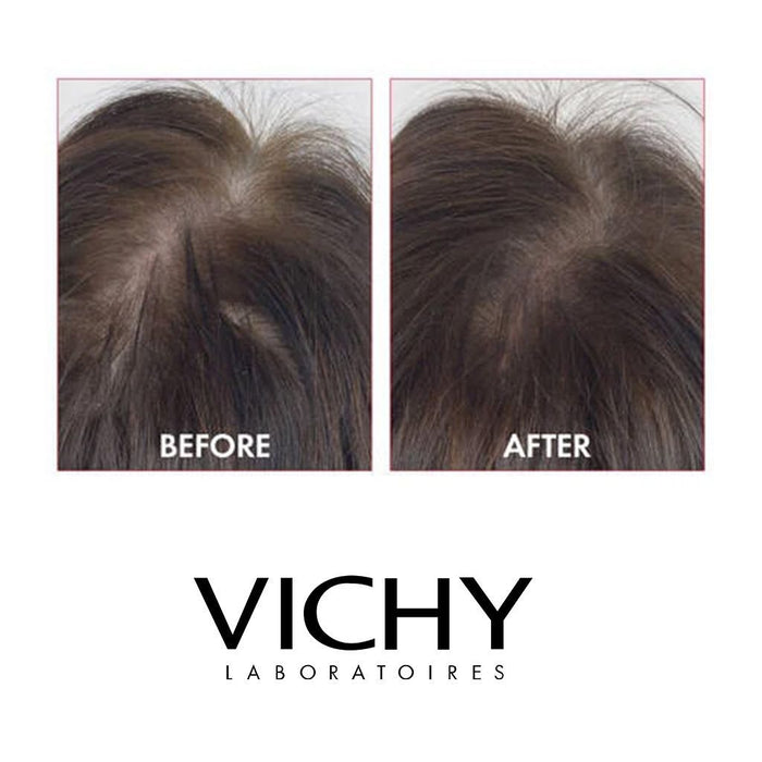 Vichy Dercos Aminexil Clinical 5 Anti-Hair Fall Treatment for Men x21 Doses, 6ml - Makkah Pharmacy