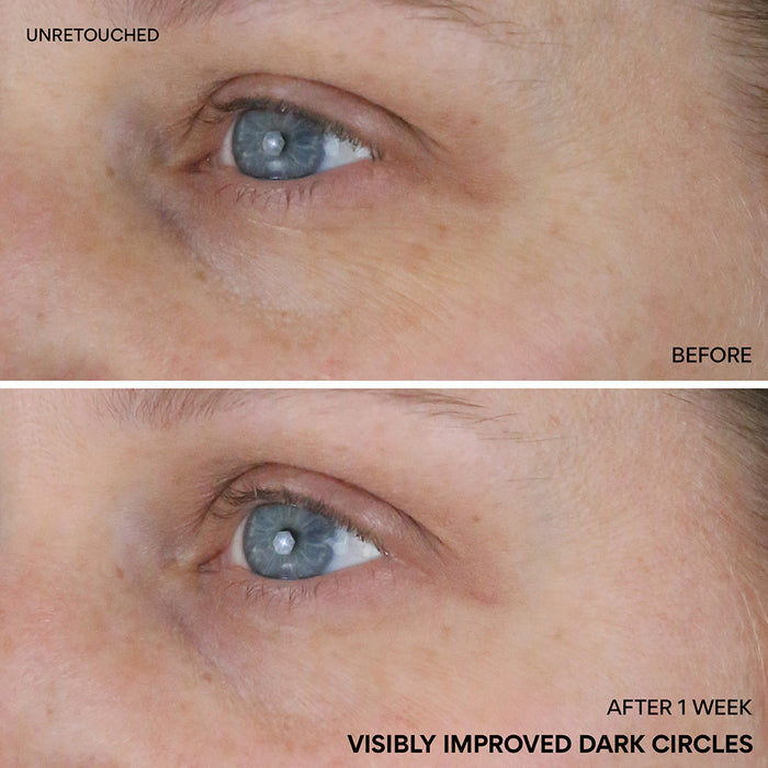 Vitamin C Niacinamide Brightening Eye Serum before and after one week visibly improved dark circles