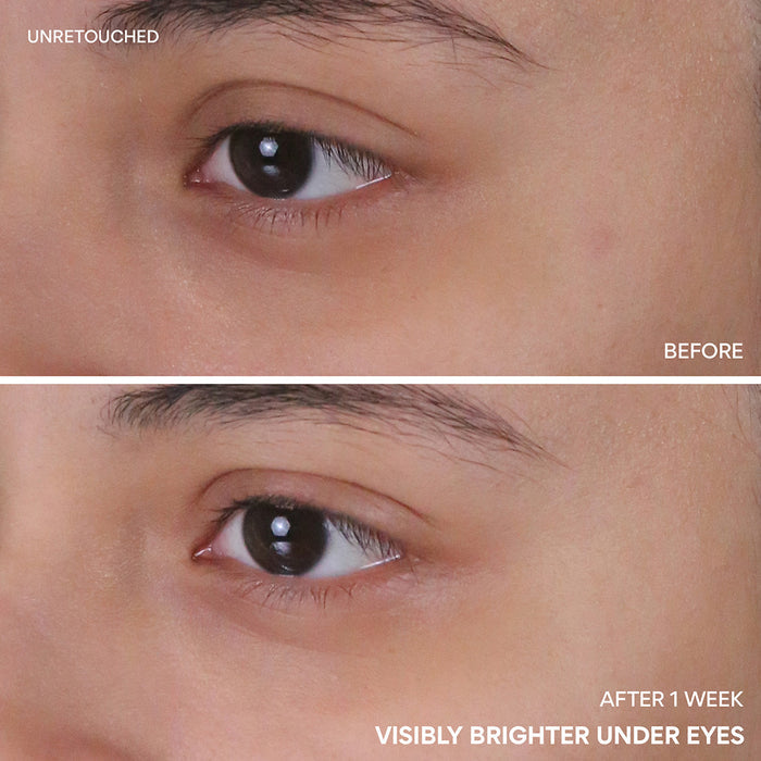Vitamin C Niacinamide Brightening Eye Serum before and after 1 week visibly brighter under eyes